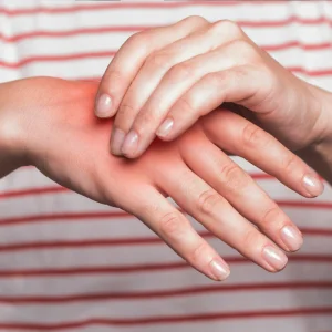 Anti-inflammatory