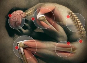 Analgesic
