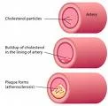 Cholesterol