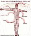 Neurologic Diseases