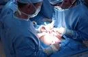 Surgery